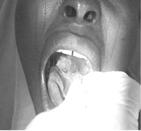 EpidémiologiqueA01